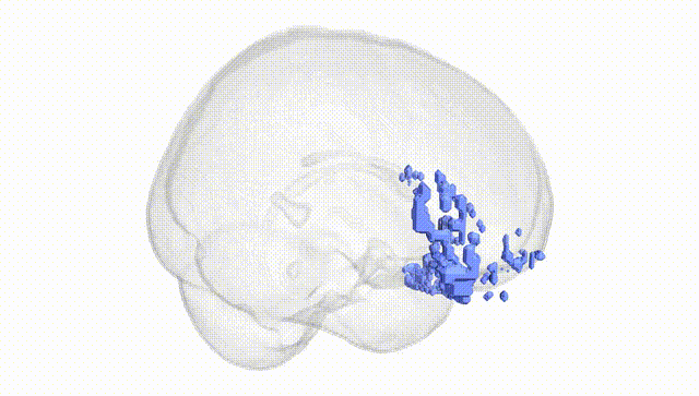 Full Brain White