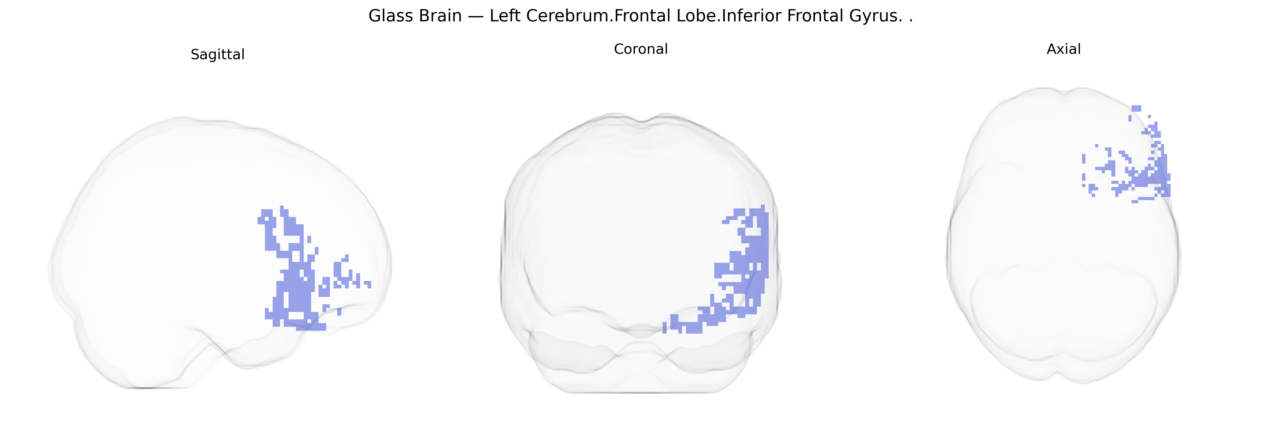 Triplanar Ghost Brain