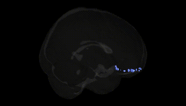 Full Brain Black