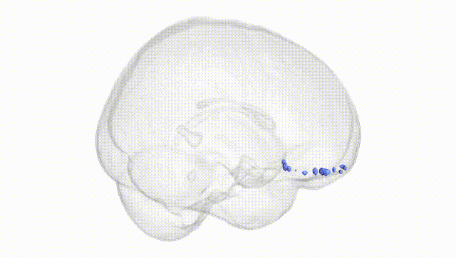 Full Brain White