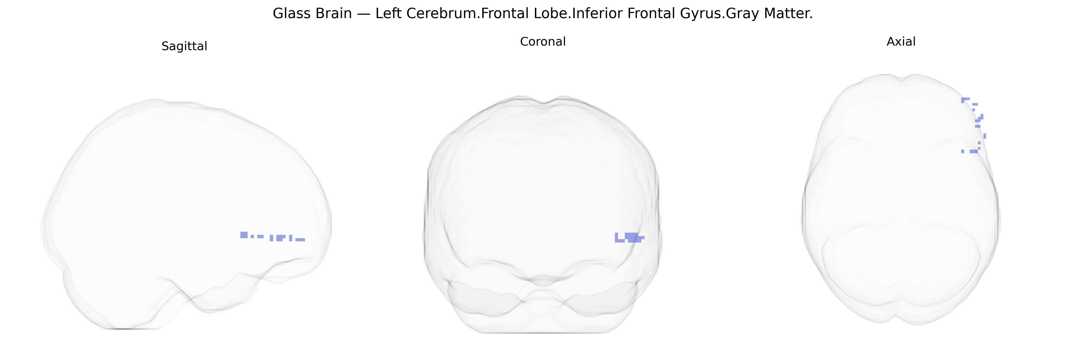 Triplanar Ghost Brain