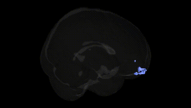 Full Brain Black
