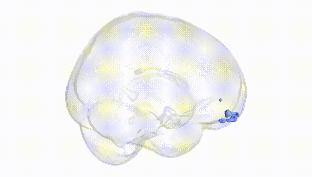 Full Brain White