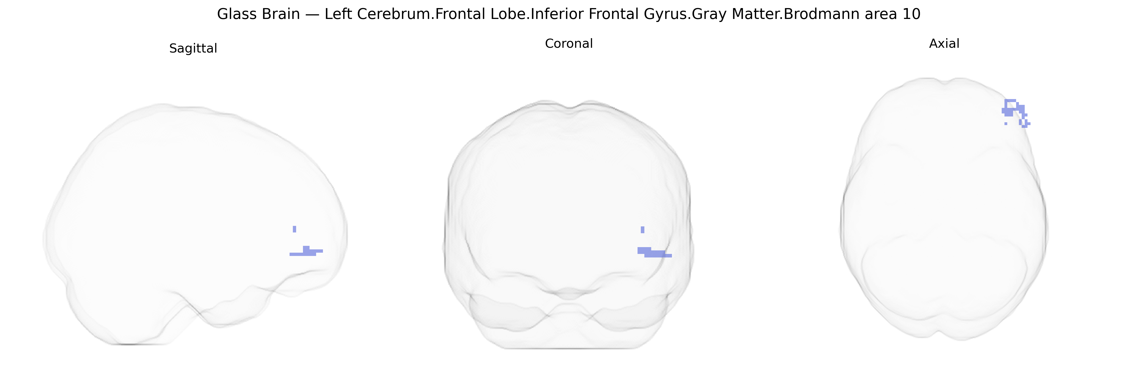 Triplanar Ghost Brain