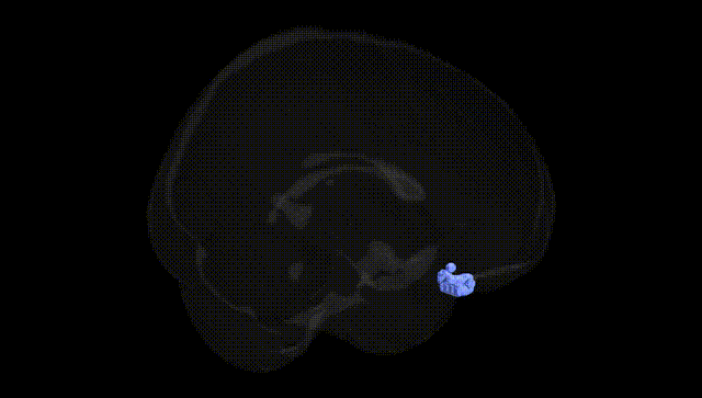 Full Brain Black