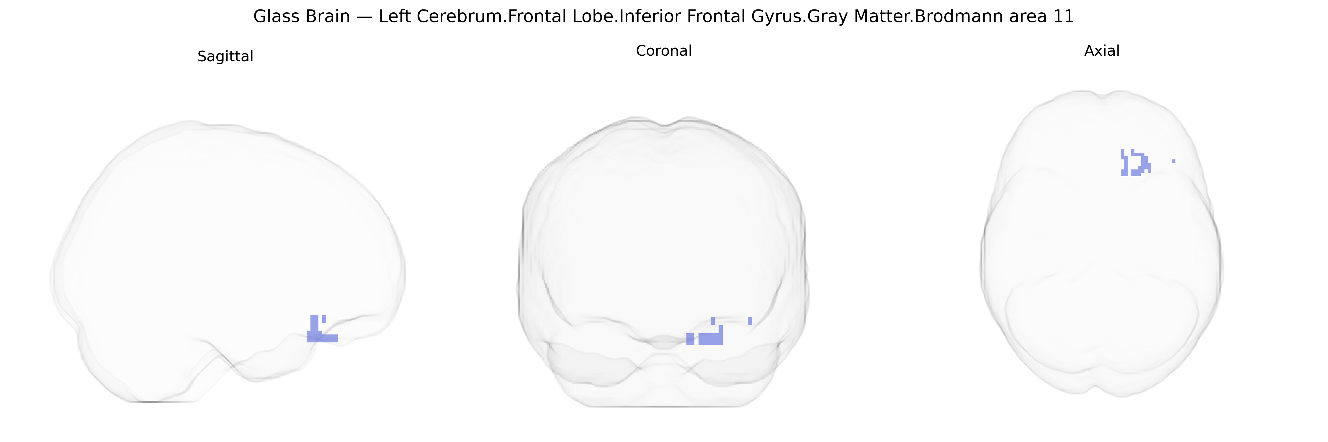 Triplanar Ghost Brain