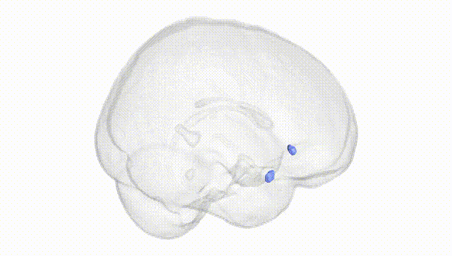 Full Brain White