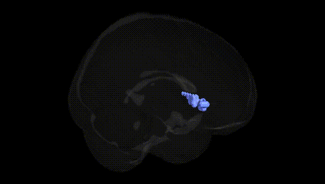 Full Brain Black