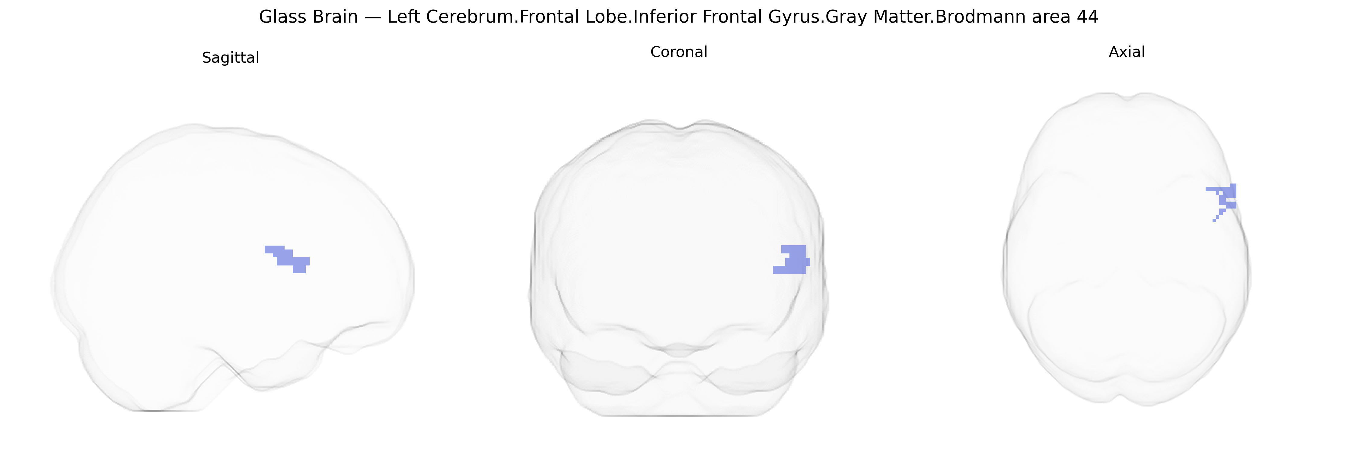 Triplanar Ghost Brain
