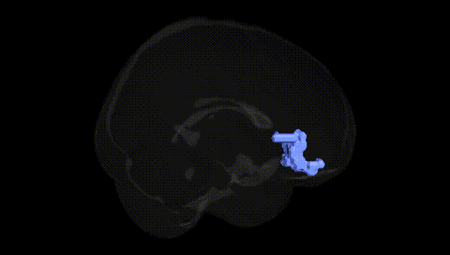 Full Brain Black