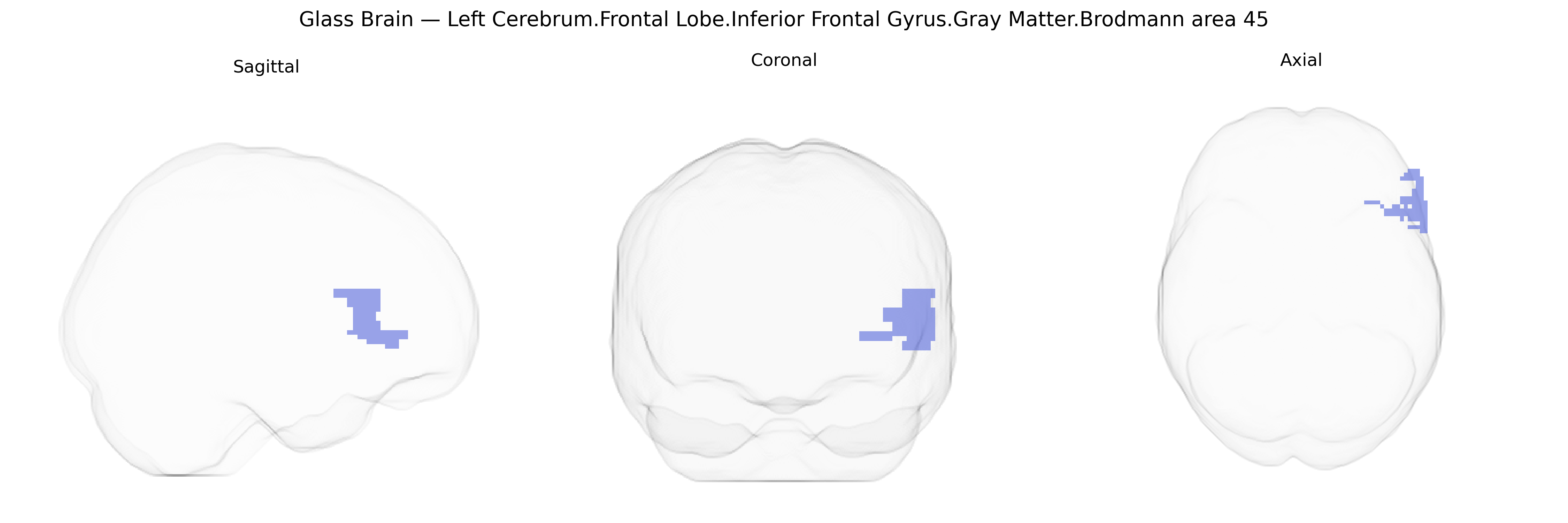 Triplanar Ghost Brain