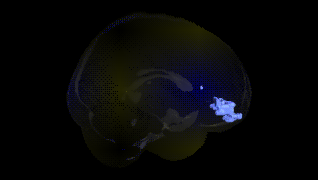 Full Brain Black