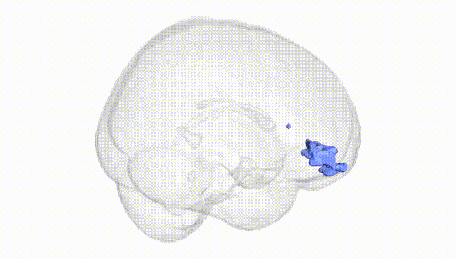 Full Brain White