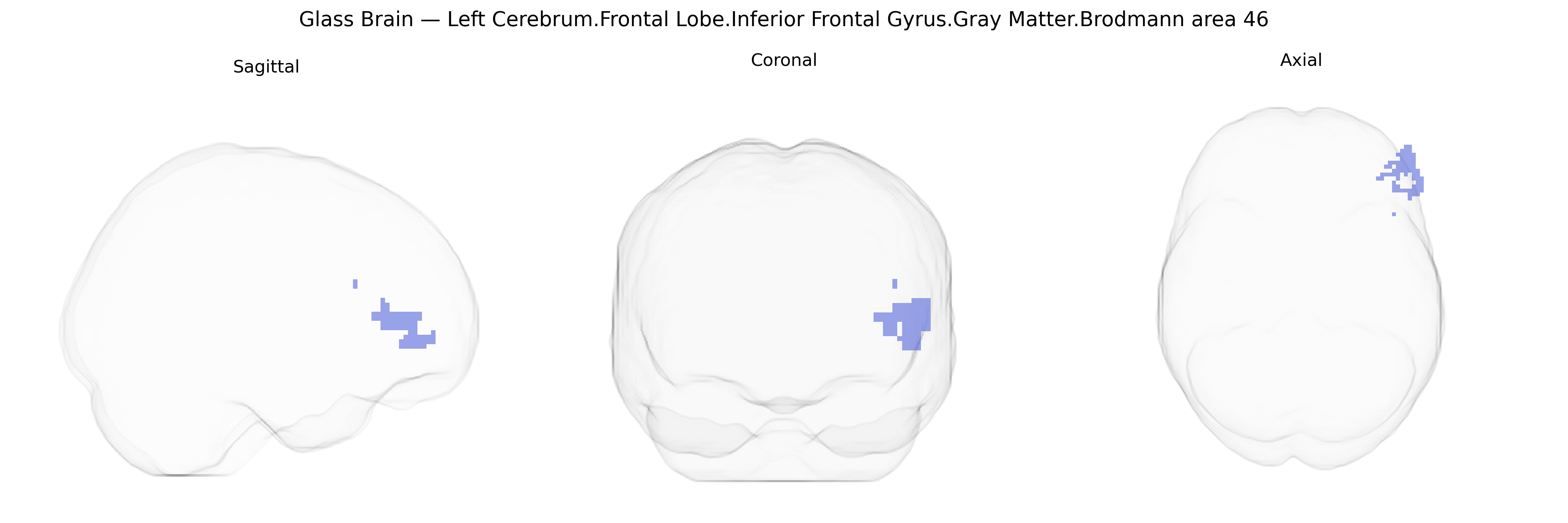 Triplanar Ghost Brain