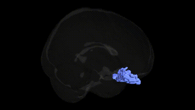 Full Brain Black