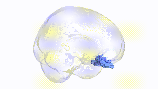 Full Brain White
