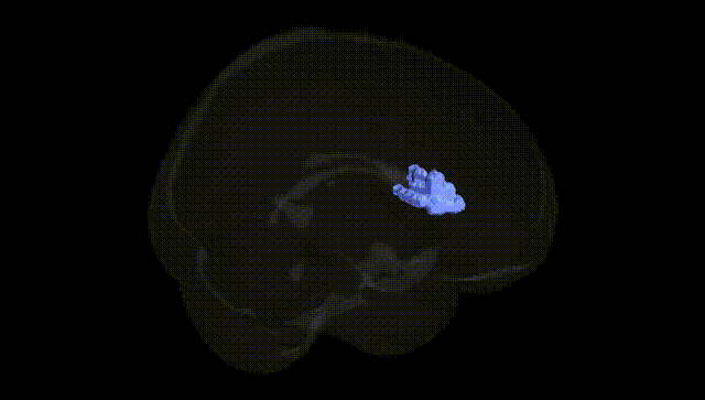 Full Brain Black