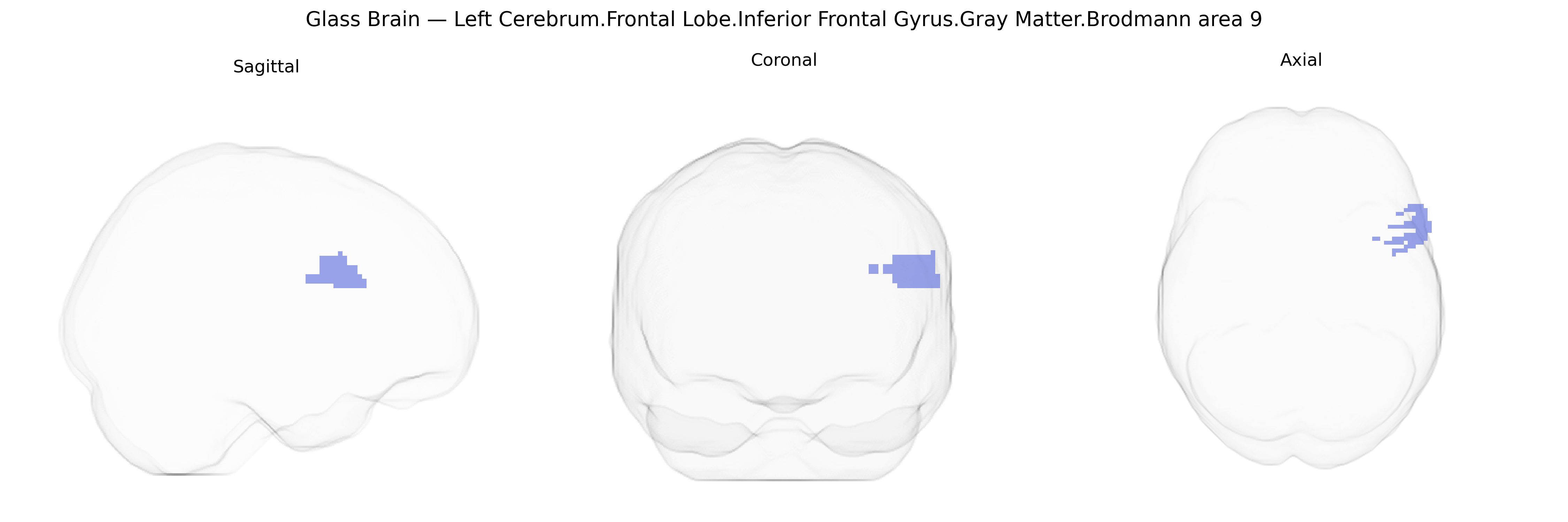 Triplanar Ghost Brain