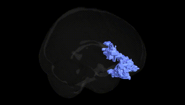 Full Brain Black