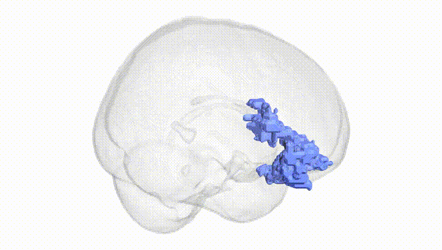Full Brain White