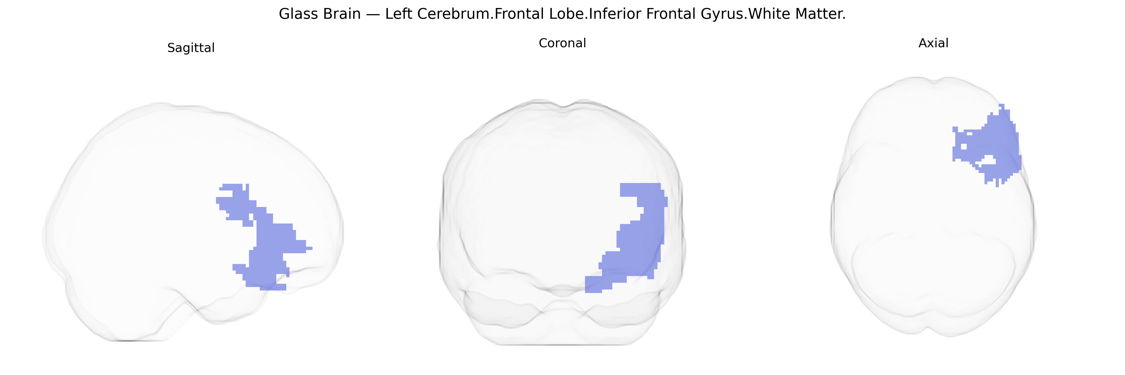 Triplanar Ghost Brain