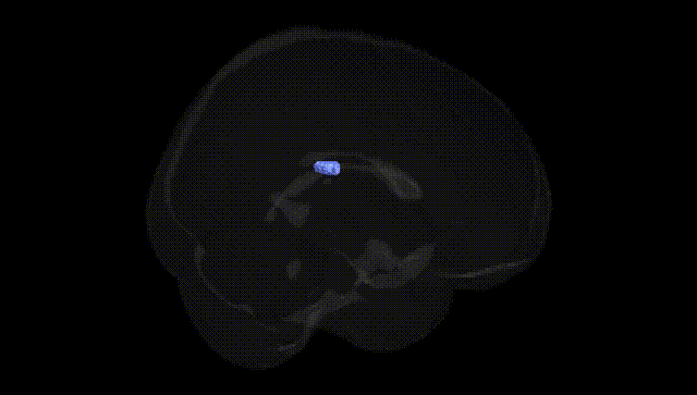Full Brain Black