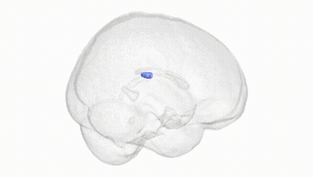 Full Brain White