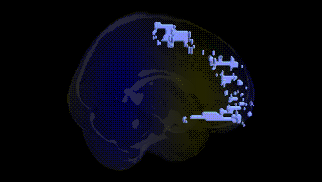 Full Brain Black