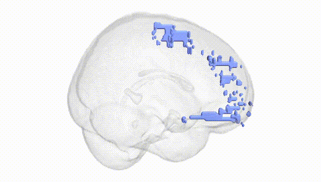 Full Brain White