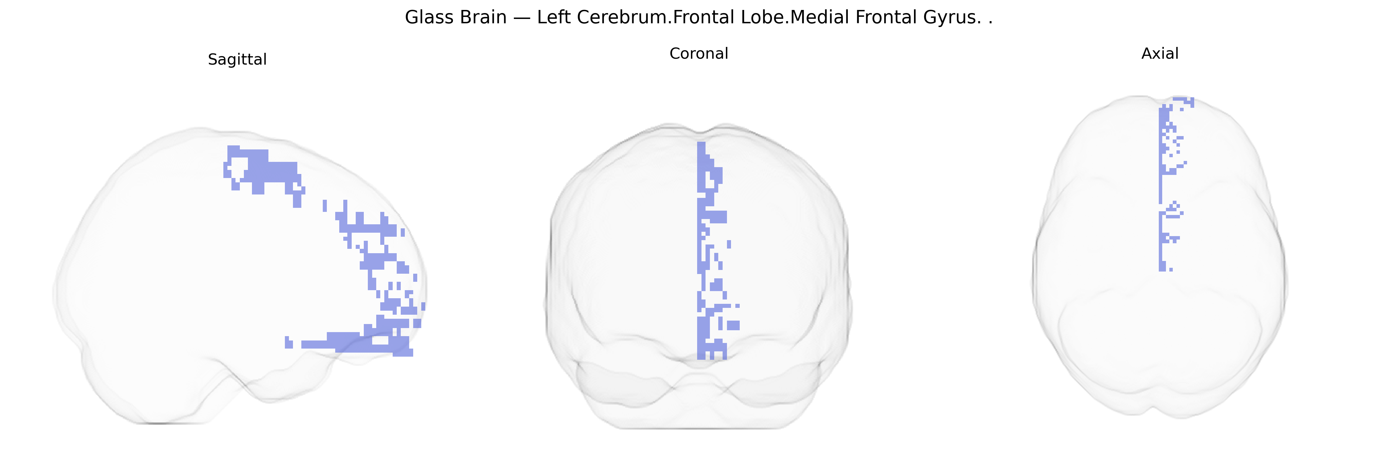 Triplanar Ghost Brain
