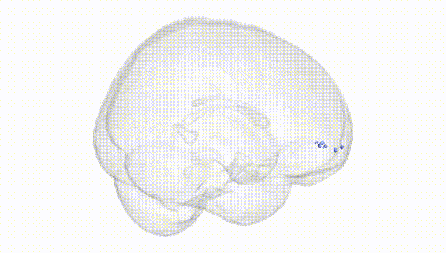 Full Brain White