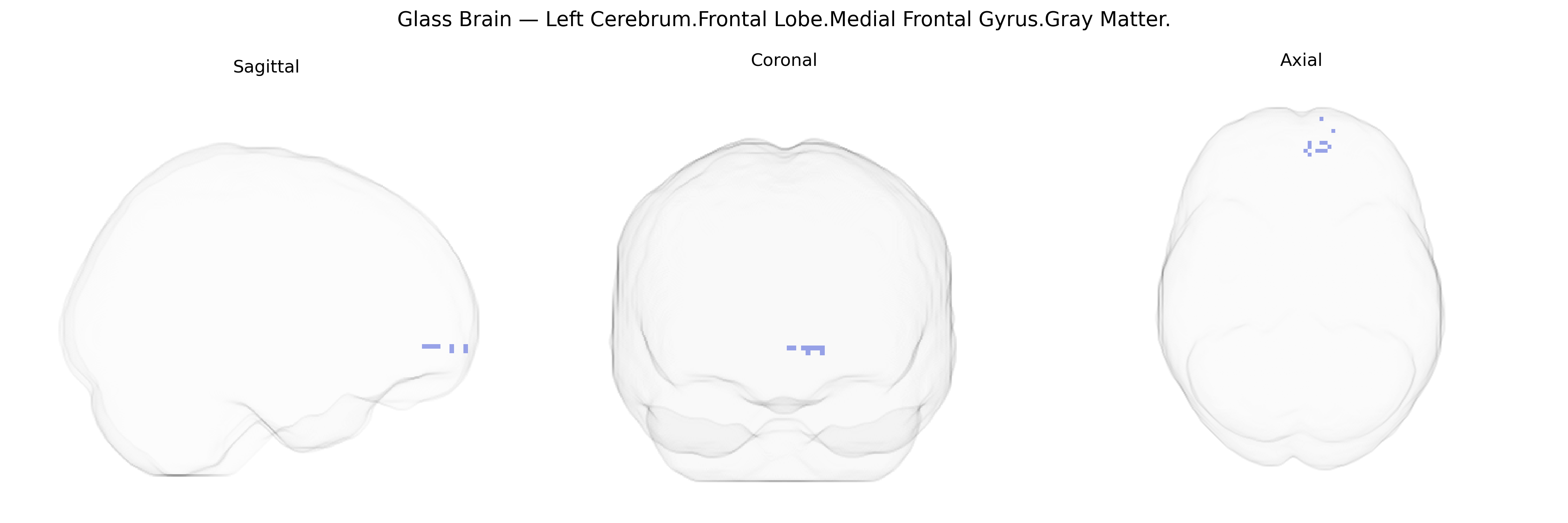 Triplanar Ghost Brain