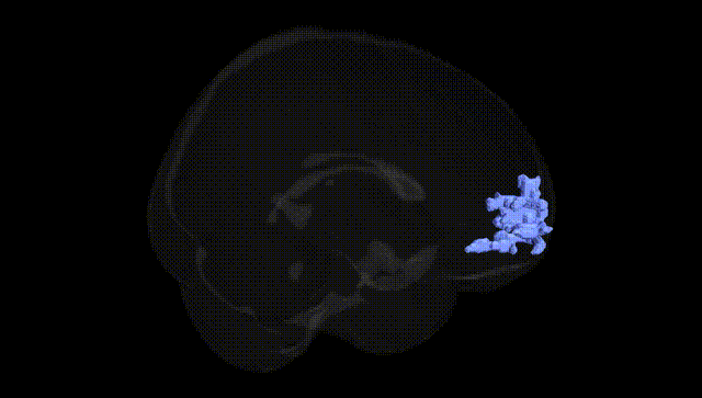Full Brain Black