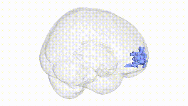 Full Brain White
