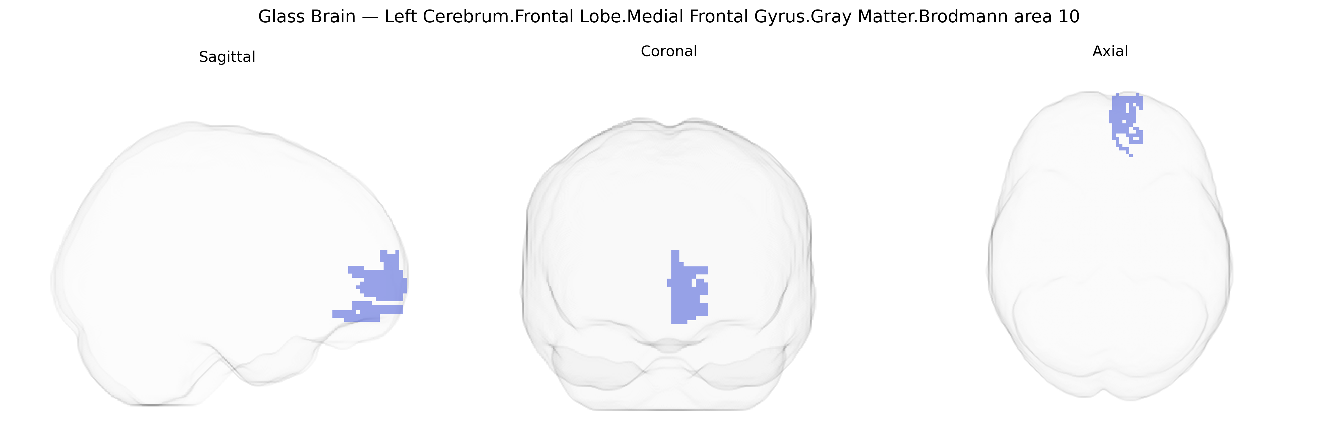 Triplanar Ghost Brain