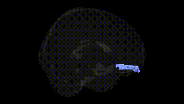 Full Brain Black