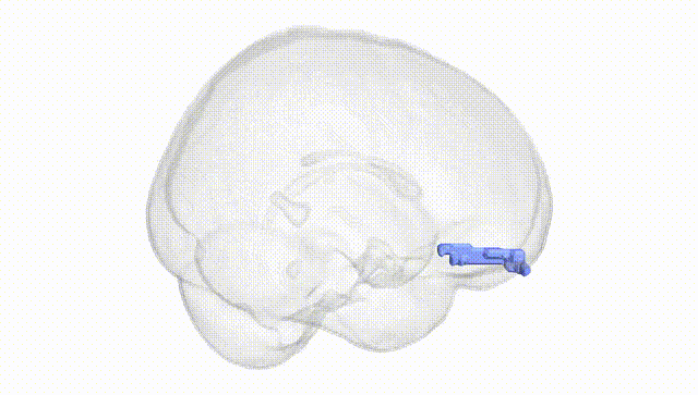Full Brain White