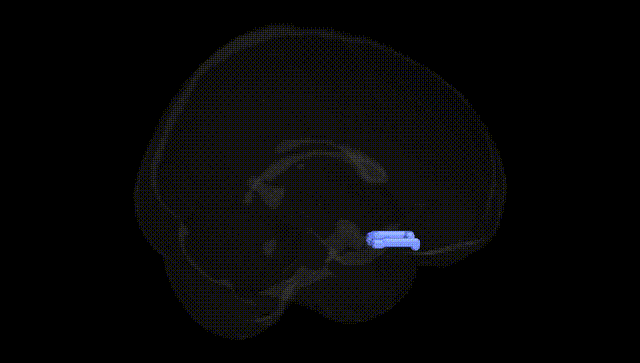 Full Brain Black