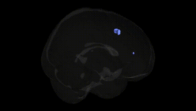 Full Brain Black