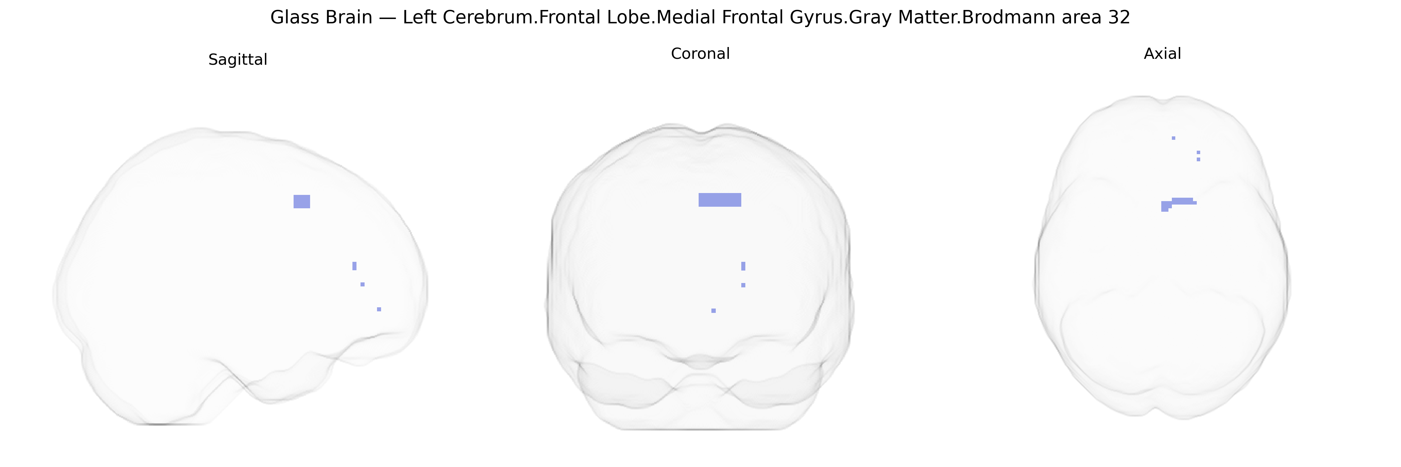 Triplanar Ghost Brain