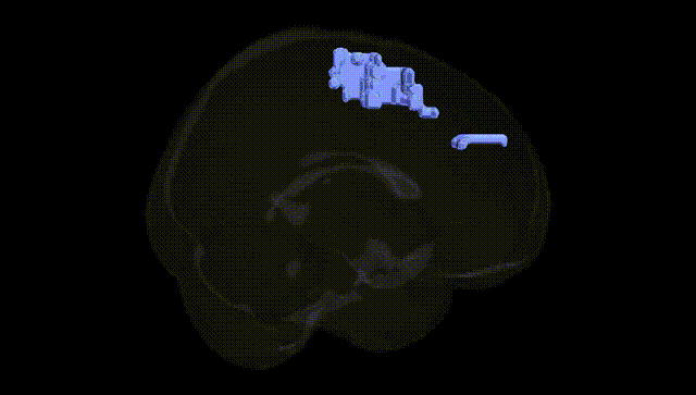 Full Brain Black
