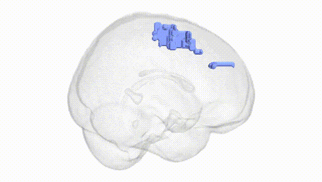 Full Brain White