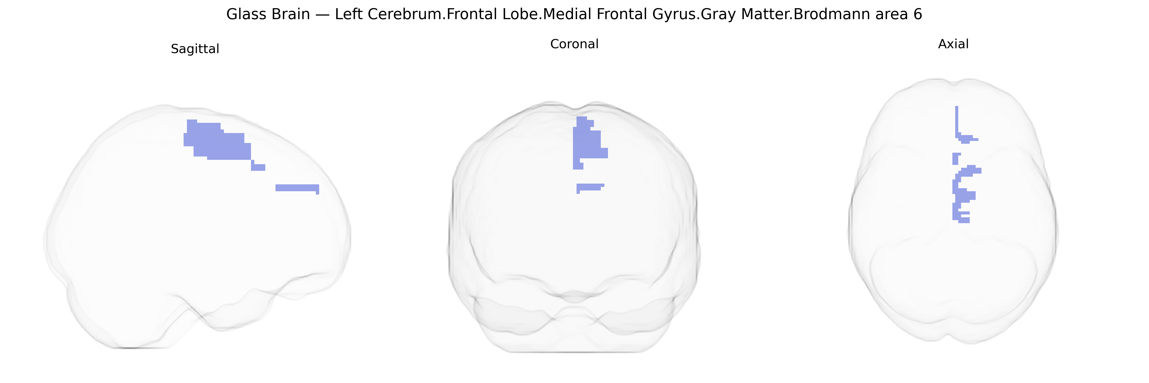 Triplanar Ghost Brain