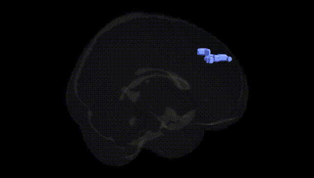 Full Brain Black