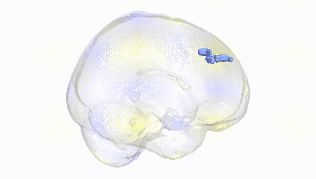 Full Brain White