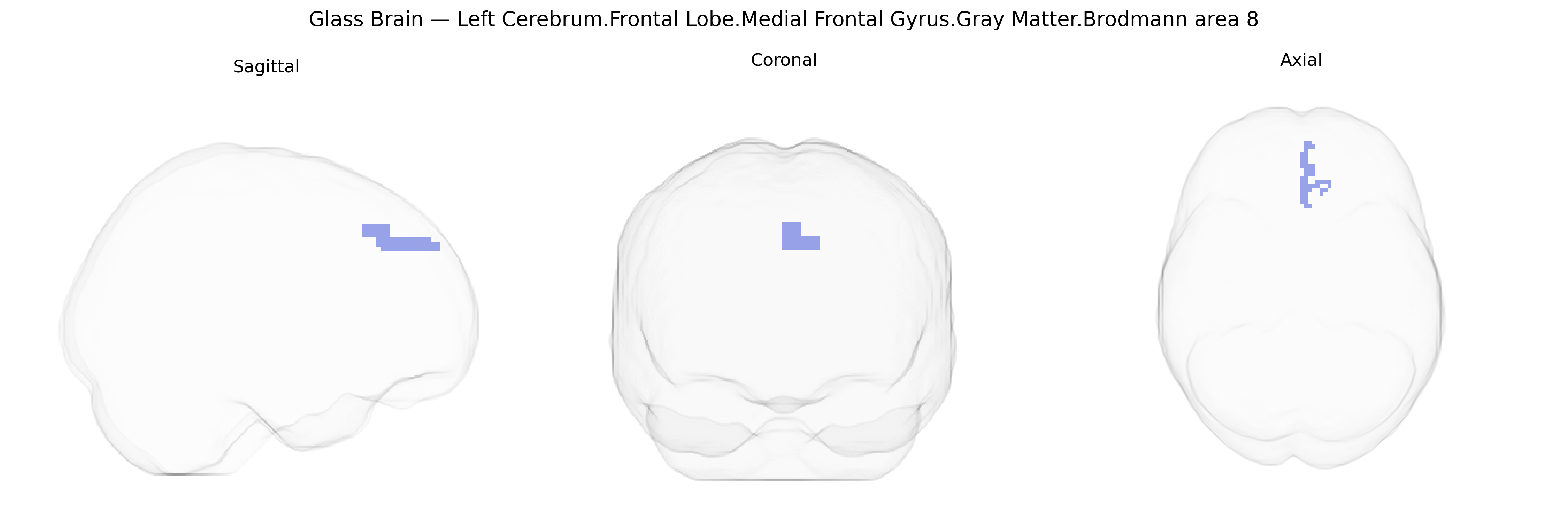 Triplanar Ghost Brain