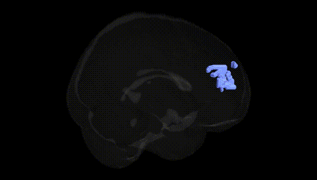 Full Brain Black