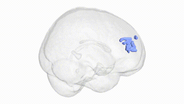 Full Brain White