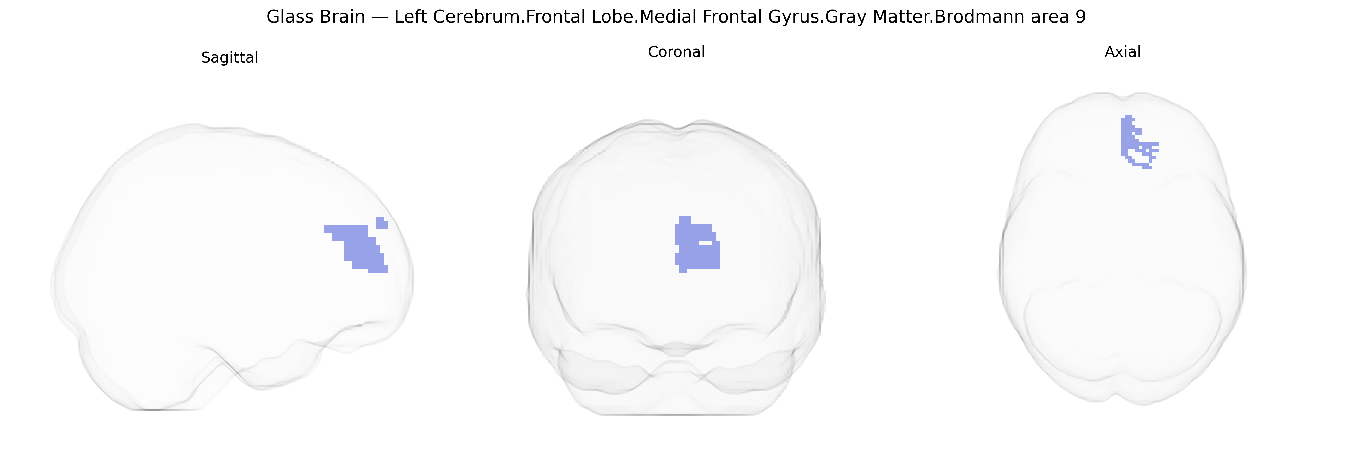 Triplanar Ghost Brain