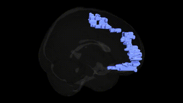 Full Brain Black